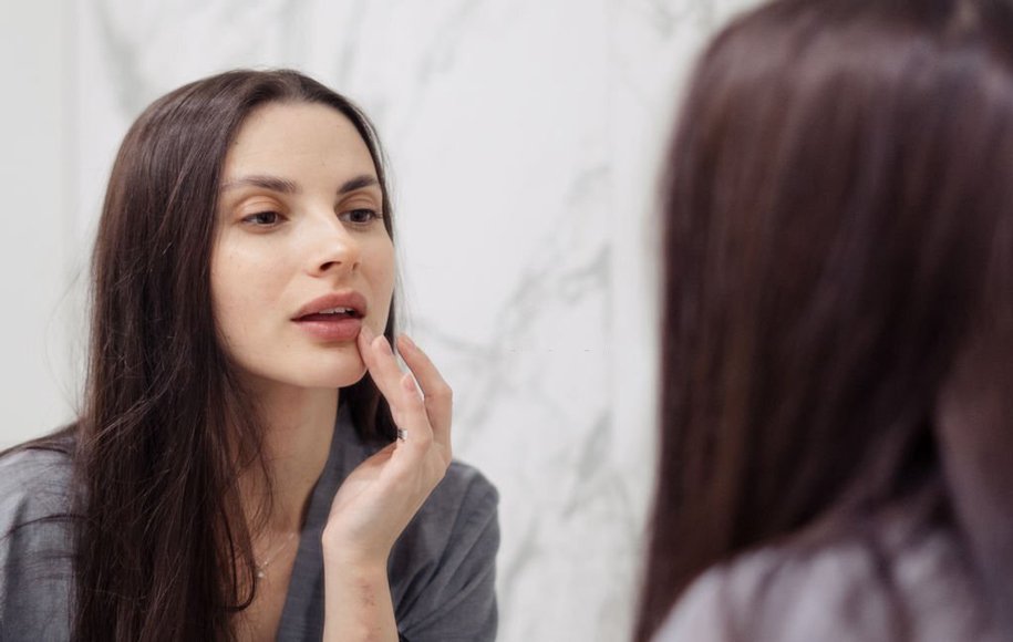 Which vitamin deficiency causes dryness and cracking of the lips?