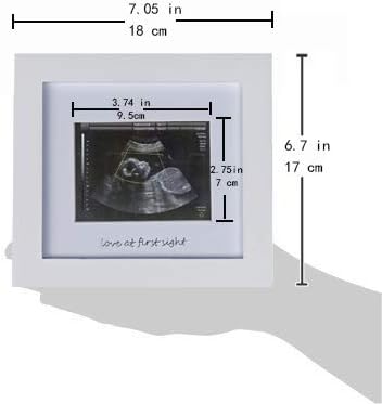 IHEIPYE Baby Sonogram Photo Frame - Ultrasound Picture Frame for Expecting Parents, Baby Showers, Gender Reveal Parties, Nursery Decor (Silver Tex...