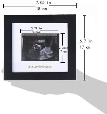 IHEIPYE Baby Sonogram Photo Frame - 1st Ultrasound Picture Frame - Idea Gift for Expecting Parents,Baby Shower, Gender Reveal Party,Baby Nursery D...
