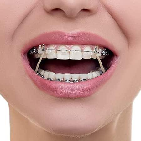 SmileSupplies Orthodontic Intraoral Latex Elastics Tooth Colours Pack of 100 Pcs + Free Placer for Braces (1/4" - 4.5 Oz)...