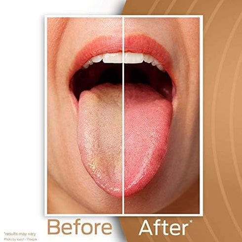DrTung’s Tongue Cleaner, Copper Tongue Scraper, Tongue Cleaner for Adults, Kids, Easy to Use Comfort Grip Handle, 2 Pack...