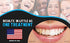 Bright White Smiles Wholesale Teeth Whitening Refill Gel Kit (4) 10cc Syringes 44% Carbamide Peroxide Bleaching Product...