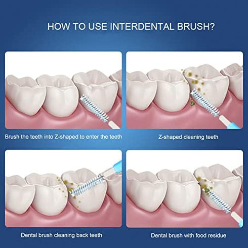 Braces Brush,Interdental Brush Toothpick, Dental Tooth Flossing Head, Oral Dental Hygiene Flosser,Toothpick Cleaners, Tooth Cleaning Tools(7Colors...