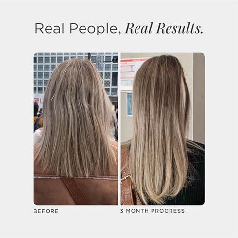 JSHealth Vitamins Hair and Energy Formula Hair Growth Vitamins | Hair Vitamins for Women and Men | Zinc and Iodine Hair Supplements for Hair Growt...