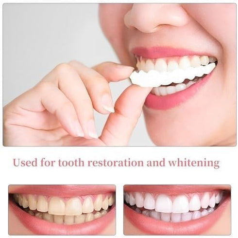 Men's and Women's Temporary Cosmetic Confident Smile...
