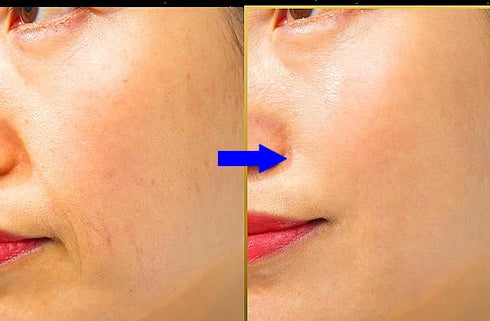 WHITESILK(???????? ????????????????) Stem cell + T1 Collagen EXPERT Power Ampoule Serum? Improve Skin Tone, Skin Barrier, Fine Lines & Wrinkle...