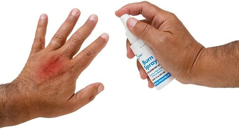Globe Burn Spray, Lidocaine 2%. Topical Anesthetic Pain Relief and Numbing 2 oz Spray Bottle...