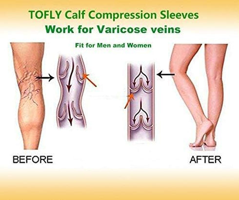 TOFLY® Calf Compression Sleeve for Men & Women, 1 Pair, Footless Compression Socks 20-30mmHg for Leg Support, Shin Splint, Pain Relief, Swelling, ...
