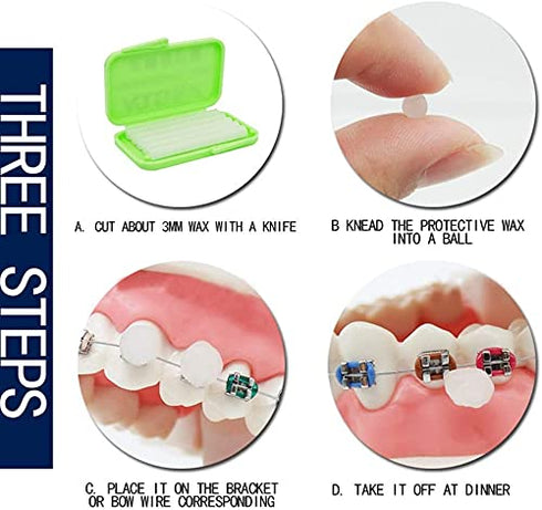 Dental Oral Care Orthodontics Wax with Fruit Smell for Brace Wearers Flavored Gum Protection (3Pack)...