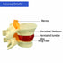 Human Anatomical Lumbar Disc Herniation Model, 1.5 Times Life Size Lumbar Disc Herniation Model, Human Lumbar Disc Herniation Model for Teaching, ...