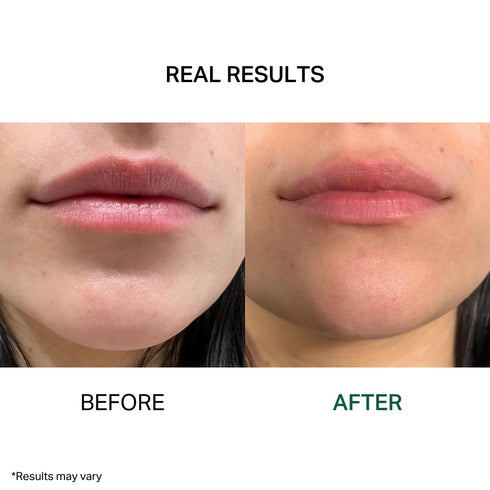 Y’OUR Intensive Lip Balm | Light-Weight & Comforting | with Natural Shea Butter & Rosehip Oil | Extreme Nourishment for Dry Lips | Paraben-Free & ...