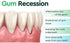 3PCS DentiZen Gum Regrowth Drops, Gum Relief Drops, Natural Gum Liquid Drops Mouthwash, Dentizen Gum Gel, Rejuvenate Your Gums with Ease...