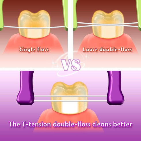 Evolutionary Clean Dental Flossers, Kit of Refills Plus Long Handle (200 T-Tension Refills)...