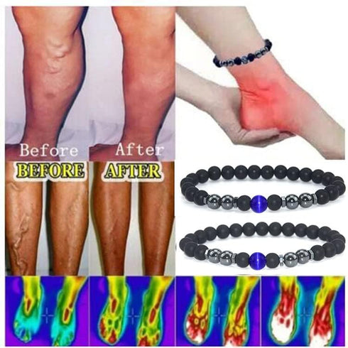 Anti-Swelling Black Obsidian Anklet, 2pcs Black Obsidian Anklet Swelling,Obsidian Beaded Bracelet For Men/Women Gifts...