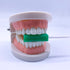 Orthodontics Chewies for Invisalign Aligner Trays, 4 Chewies, Mint Scented, Cuboid, Non-Slip...