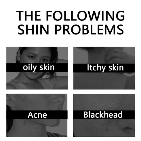 Kojic Acid Soap, Face & Body Bath Soap, Skin Soap, Uneven Skin Soap with Tea Tree, Coconut Oil, Vegan Soap...