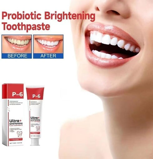 SP-6 Ultra Whitening, SP 6 Toothpaste, Ultra Whitening Toothpaste Sp - 6, Probiotic Brightening Toothpaste,Deep Cleaning Care Toothpaste,Fresh Bre...