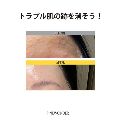 Tamanu Hero Clay-fit Mask (3EA), Clay Sheet Mask for Pores, Tamanu Oil and Panthenol for Acne and Oily Skin, Pore and Blackhead Care, Korean Skinc...