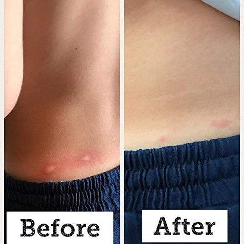 BabyBiotics - Topical Probiotic Body Care for Children of All Ages 4oz -Hypoallergenic, Vegan, Non GMO, GF, 100% Natural Live Probiotic, External ...