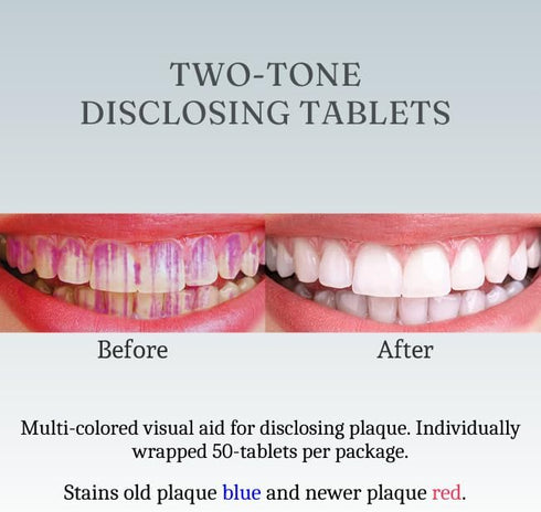 Dental Disclosing Tablets for Kids and Adults - Individually Wrapped Plaque Disclosing Tablets for Teeth, Safe & Effective Two-Tone Dental Cleanin...