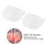 Bunion Corrector Big Toe Separators, Bunion Splint Gel Bunion Pads,Toe Straightener Joint Pain Relief Aid - Toes Shape - Toe Spreader Bunion Cushi...