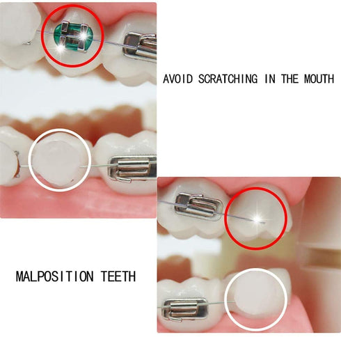 Dental Oral Care Orthodontics Wax with Fruit Smell for Brace Wearers Flavored Gum Protection (3Pack)...