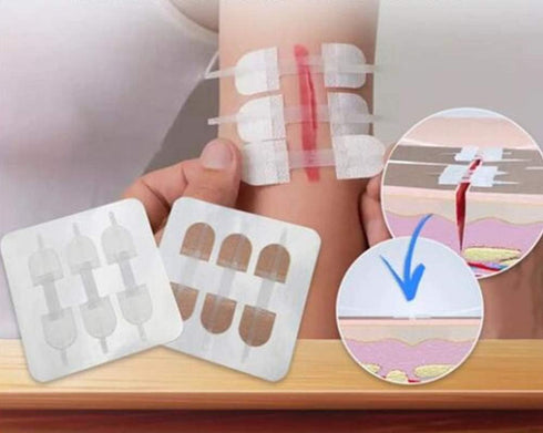 Emergency Wound Closures Adhesive Bandages, Zip Stitch Stickers for Camping, Survival & Household Gear, 3 Pcs (70*22mm, Skin)...
