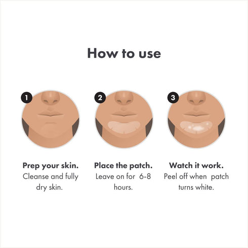 Mighty Patch™ Chin Patch from Hero Cosmetics - XL Contoured Hydrocolloid Chin Patch for Blemishes and Pimples, Non-Irritating, Vegan-Friendly, Not...