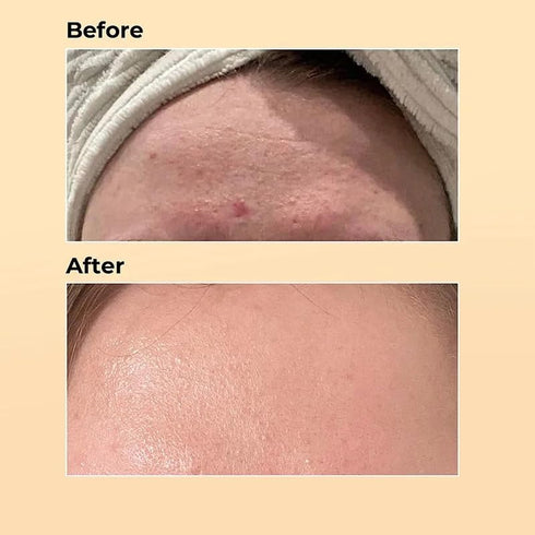 Advanced Snail Mucin 96% Power Repairing Essence 3.38 fl.oz 100ml, Hydrating Serum for Face with Snail Secretion Filtrate for Dull Skin & Fine Lin...