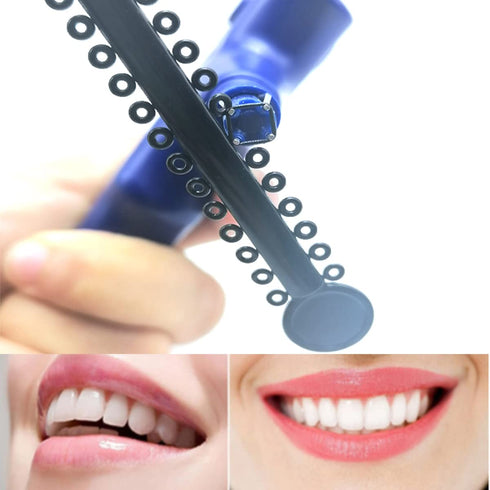 1040 Pcs Black Braces Rubber Bands Orthodontic Ligature Ties O-Rings Elastic Bands for Braces (Black)...