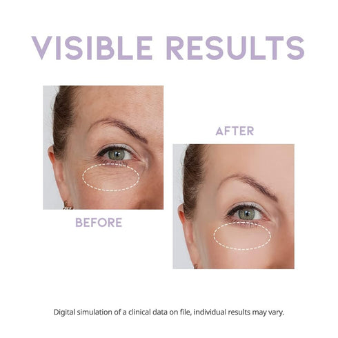 Eye cream for dark circles puffiness and bags anti aging wrinkles korean cream peptide, vitamin c, collagen, vegan under eye treatment 25g...