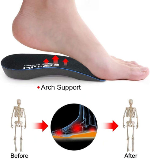 Dr. Foot's 3/4 Length Orthotic Inserts, Self-Adhesive Half Shoe Insoles for Flat Feet, Plantar Fasciitis, Fallen Arches, Over-Pronation, Heel Spur...