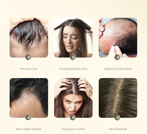 2 Box Ginger Plant Extract Anti-Hair Loss Hair Shampoo, Ginger Shampoo for Hair Growth Oil Control Hair Care Plant Shampoo for Women Men. (400g)...