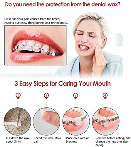 Dental Oral Care Orthodontics Wax with Fruit Smell for Brace Wearers Flavored Gum Protection (3Pack)...