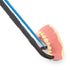 SDFlosser SDF Delivery System, Trial Pack...