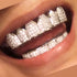 JINAO Grillz Diamond Grills for Your Teeth for Men Women 18K Gold Plated Iced Out Macro Pave Cubic Zirconia Mouth Grill with Extra Molding Bars In...