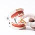 Dental IPR Strip System 10Pcs Orthodontic Interproximal Reduction Enamel Kits (A/Multi-Colored)...