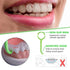 4 Pcs Remover Tool Clear Aligner Removal Tool for Invisible Removable Braces (green)...