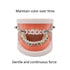 1040 O-Rings - Orthodontic Elastomeric Ligature Ties for Braces. Elastic O-Ring Rubber Bands for Orthodontic Brackets. (Pastel Blue)...