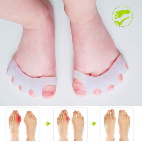 GloDeals Bunion Corrector 6 PCS Kids Toe Separator, Kids Toe Separator Soft Gel Bunion Pad&Spacer Kit Bunion Cushions Drift Pain Pads for Feet Ove...