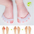 GloDeals Bunion Corrector 6 PCS Kids Toe Separator, Kids Toe Separator Soft Gel Bunion Pad&Spacer Kit Bunion Cushions Drift Pain Pads for Feet Ove...