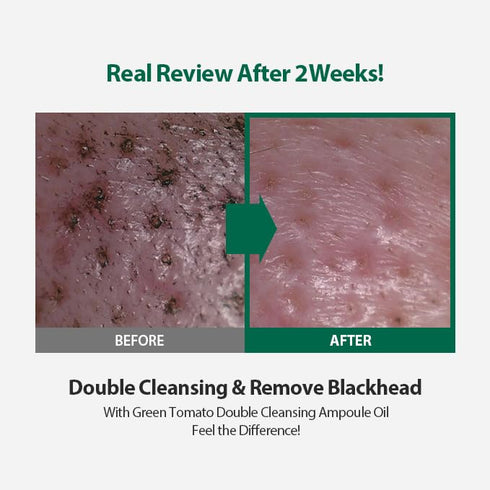 Green Tomato Double Cleansing Ampoule Oil 200g | Daily Makeup Blackhead Melting | Double Cleansing | for Women Korean Skin care...