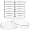 20 Pcs Plastic Petri Dishes with Lids, 60x15mm Sterile Culture Dishes...