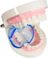 Dental Orthodontic Lip Cheek Retractor Expander Mouth Opener Autoclavable for Posterior Teeth (15 Pieces/lot)...