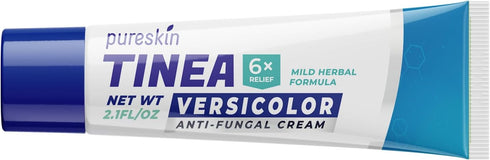 Tinea Versicolor Treatment Antifungal Cream: Extra Strength Natural Anti Fungal Anti Itch - for Tinea Versicolor Ringworm Athlete's Foot Jock Itch...