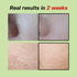 Green Tomato Pore Lifting Ampoule + | Instant Pore Minimizing & Tightening Facial Serum for Enlarged and Saggy Pores | Korean Skincare | 1.01 Fl O...