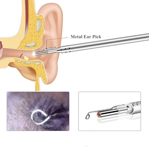 9PCS Earpick Spoon, Accessories for 3.5mm Diameter Otoscope - Metal Ear Spoon, Spiral Ear Pick for Adults Children...