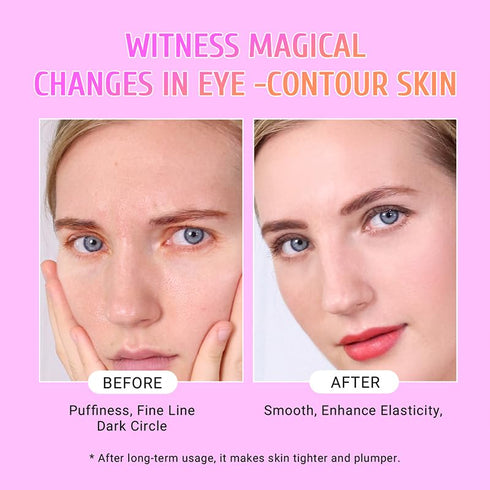 Under Eye Patches (30 Pairs) Gold Eye Mask and Hyaluronic Acid Eye Patches for puffy eyes,Rose Eye Masks for Dark Circles and Puffiness under eye ...
