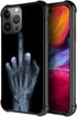 ZHEGAILIAN Case Compatible with iPhone 15 Pro Max,Skull Hand X-ray 15 Pro Max Cases for Men/Boys,UNBreak Reinforced Corners Back Cover Soft TPU Bu...