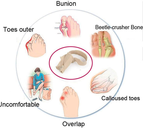Bunion Straightener Protector Relief Sleeve w/Gel Bunion Stretchy Pads Cushioned Splint, Orthopedic Hallux Valgus Overlapping Corrector Bootie Gua...
